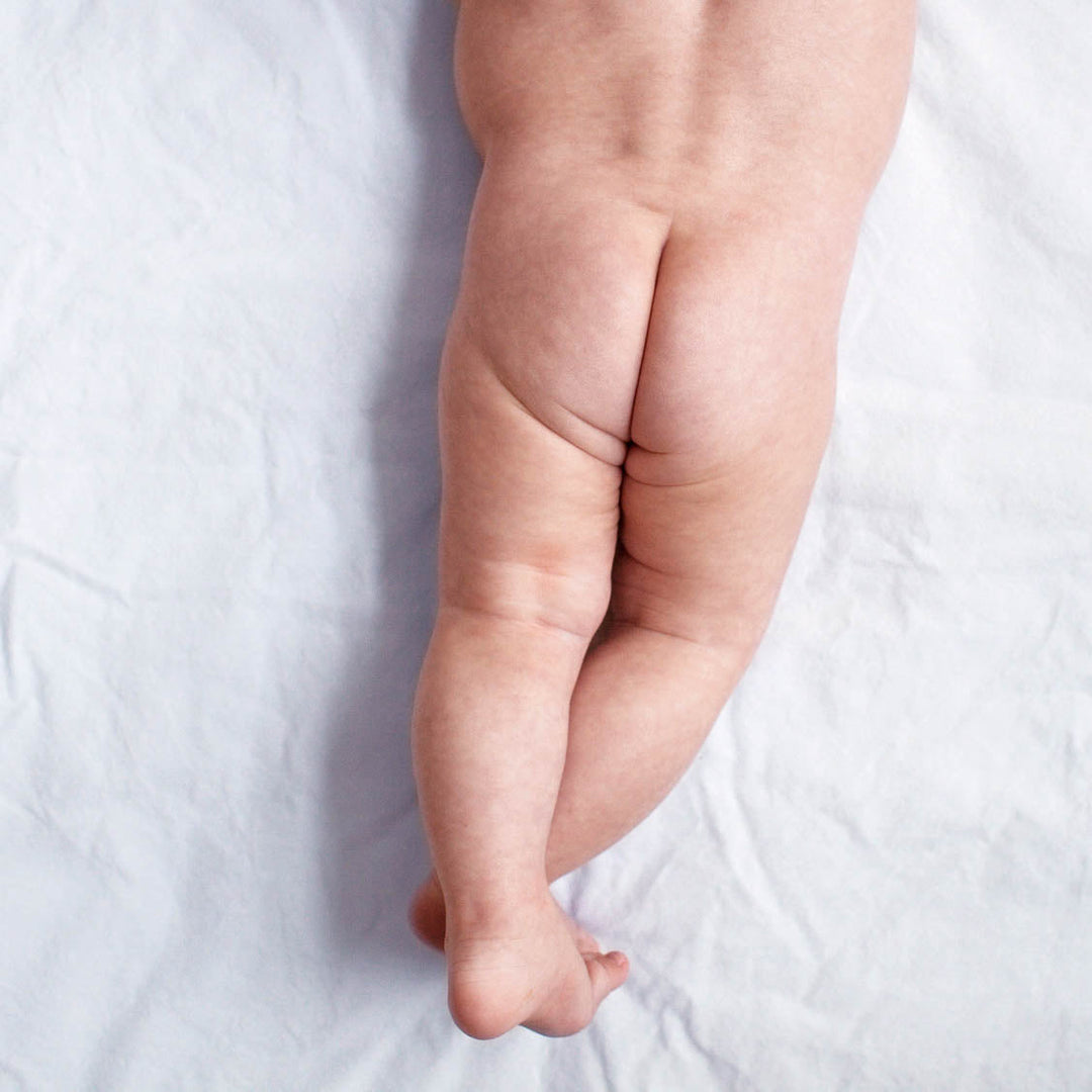 Diaper Rash Dilemma